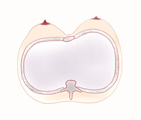 左右非対称の胸